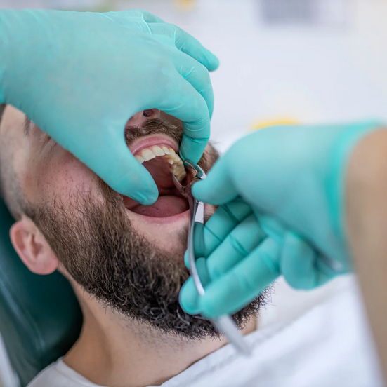 تكلفة خلع ضرس العقل